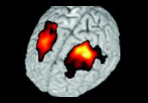 Сканирование мозга. Напомнить о том, что изображение с веб-сайта www. livescience. com